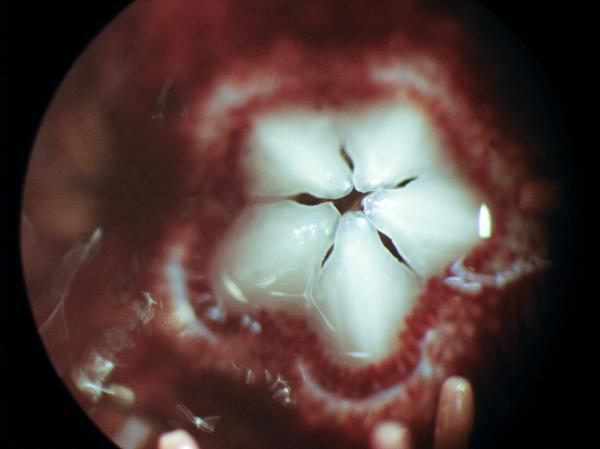 SEA URCHIN TEETH